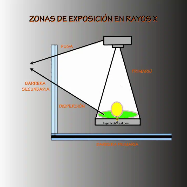 Zonas de exposición en rayos x